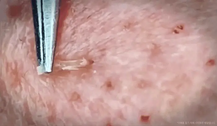 [1등모공패드] 메디큐브 제로 모공 패드 2.0 70매 상세페이지 9